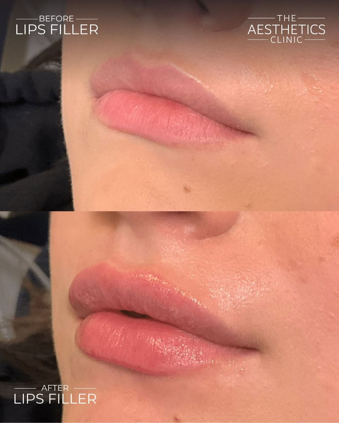 Post 4 by The Aesthetics Clinic ® on Instagram (image)