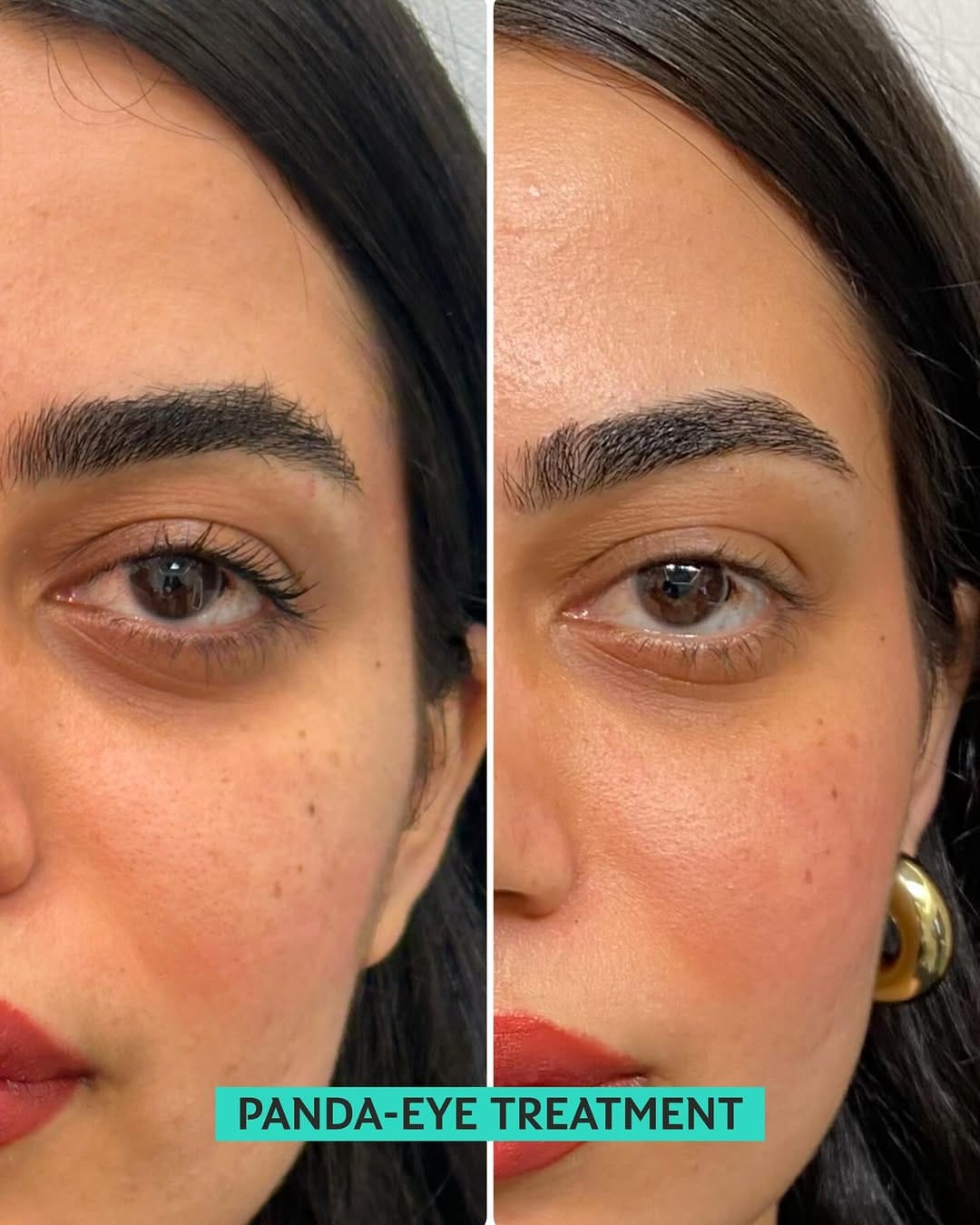 Post 1 by Estelaza Clinic on Instagram (image)
