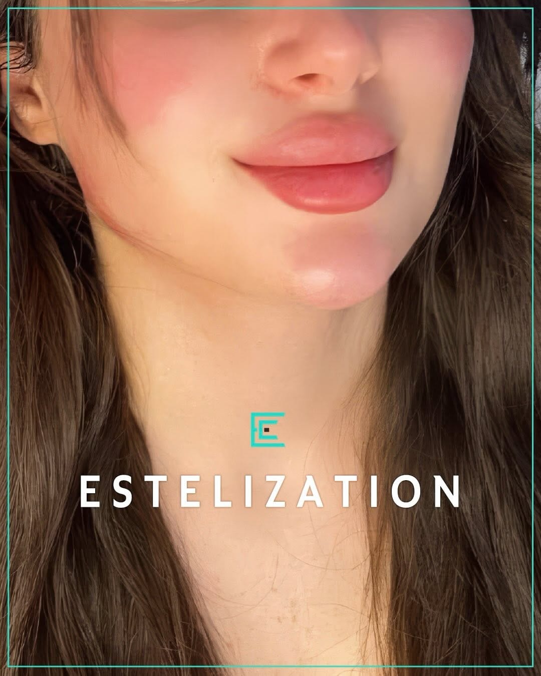 Post 2 by Estelaza Clinic on Instagram (carousel)