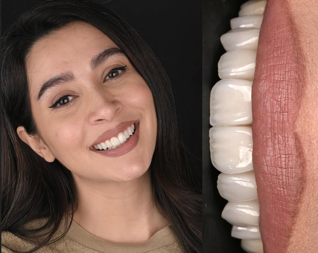 Post 5 by Tahereh Zehtaban-Dentist on Instagram (image)