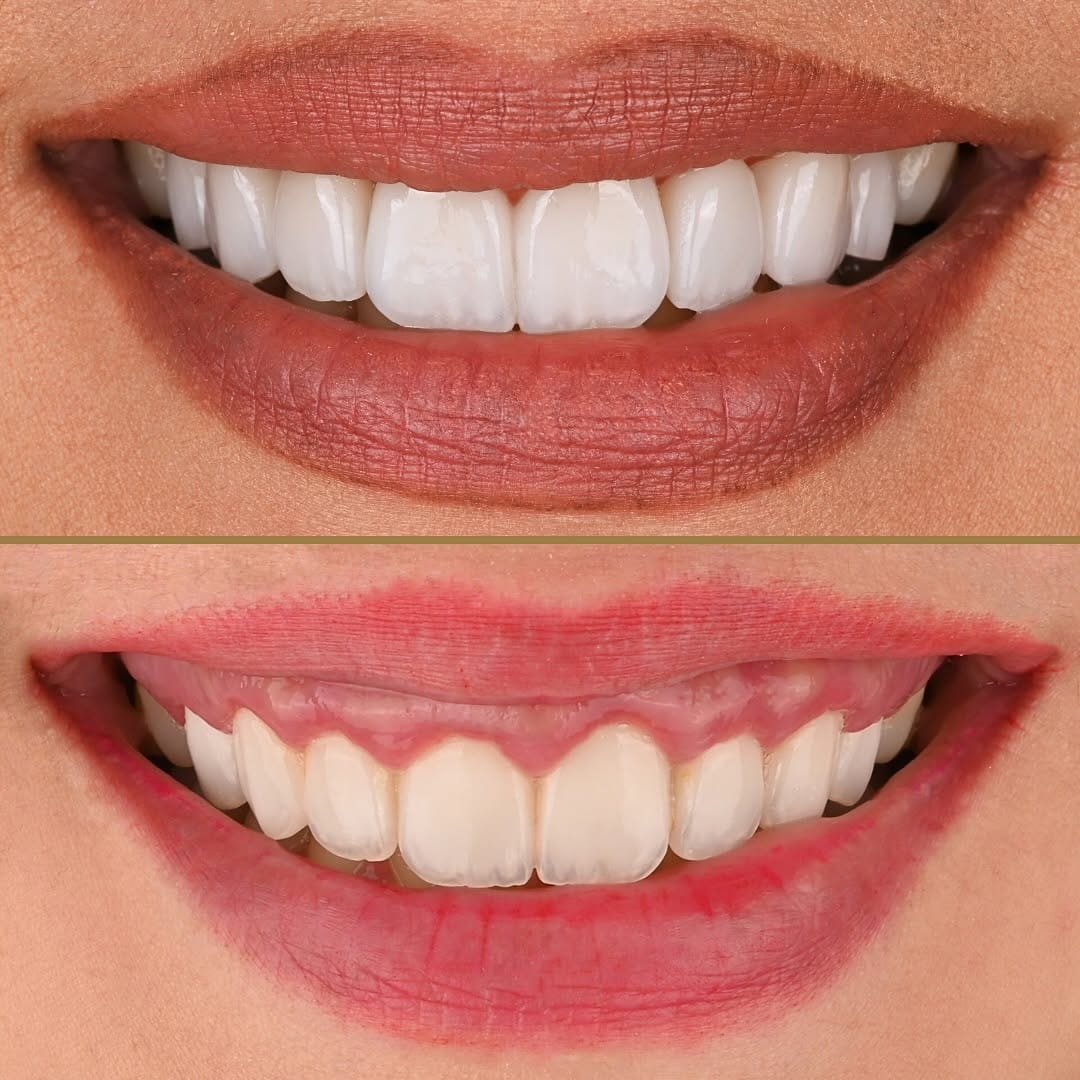 Post 6 by Tahereh Zehtaban-Dentist on Instagram (carousel)