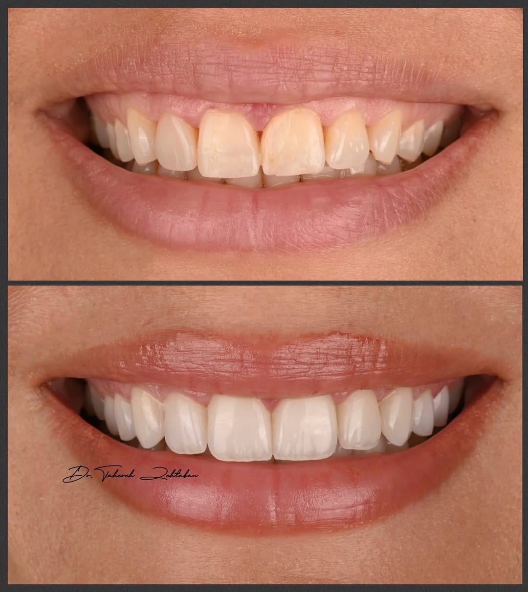 Post 3 by Tahereh Zehtaban-Dentist on Instagram (carousel)