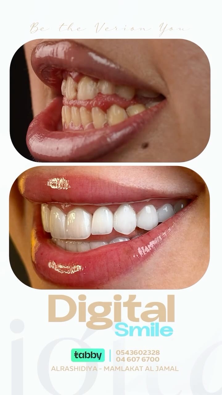 Post 4 by Be You Clinics - عيادات بي يو on Instagram (video)