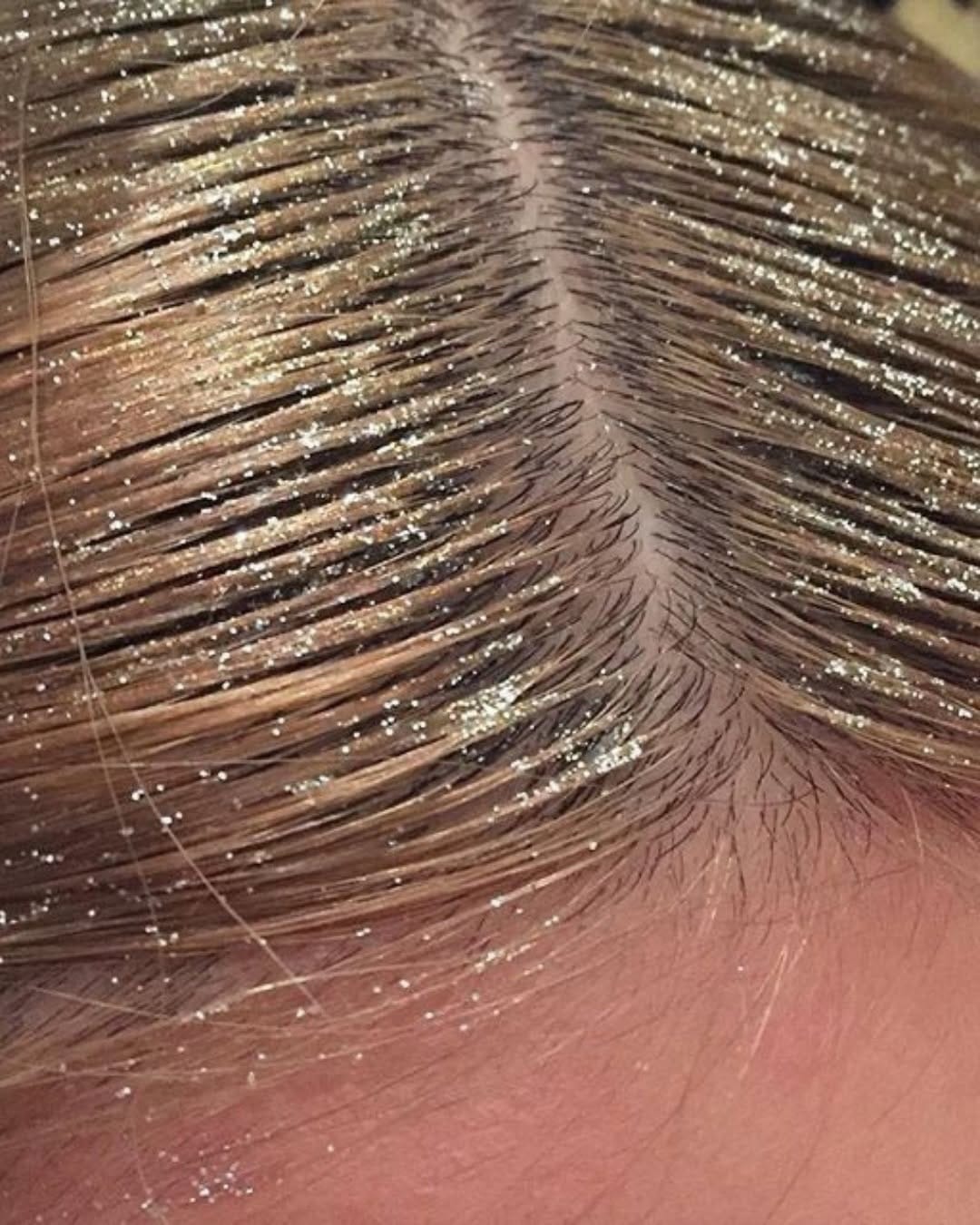 Post 1 by Wellkin | Korean Head Spa & Hair Loss Care Dubai on Instagram (carousel)