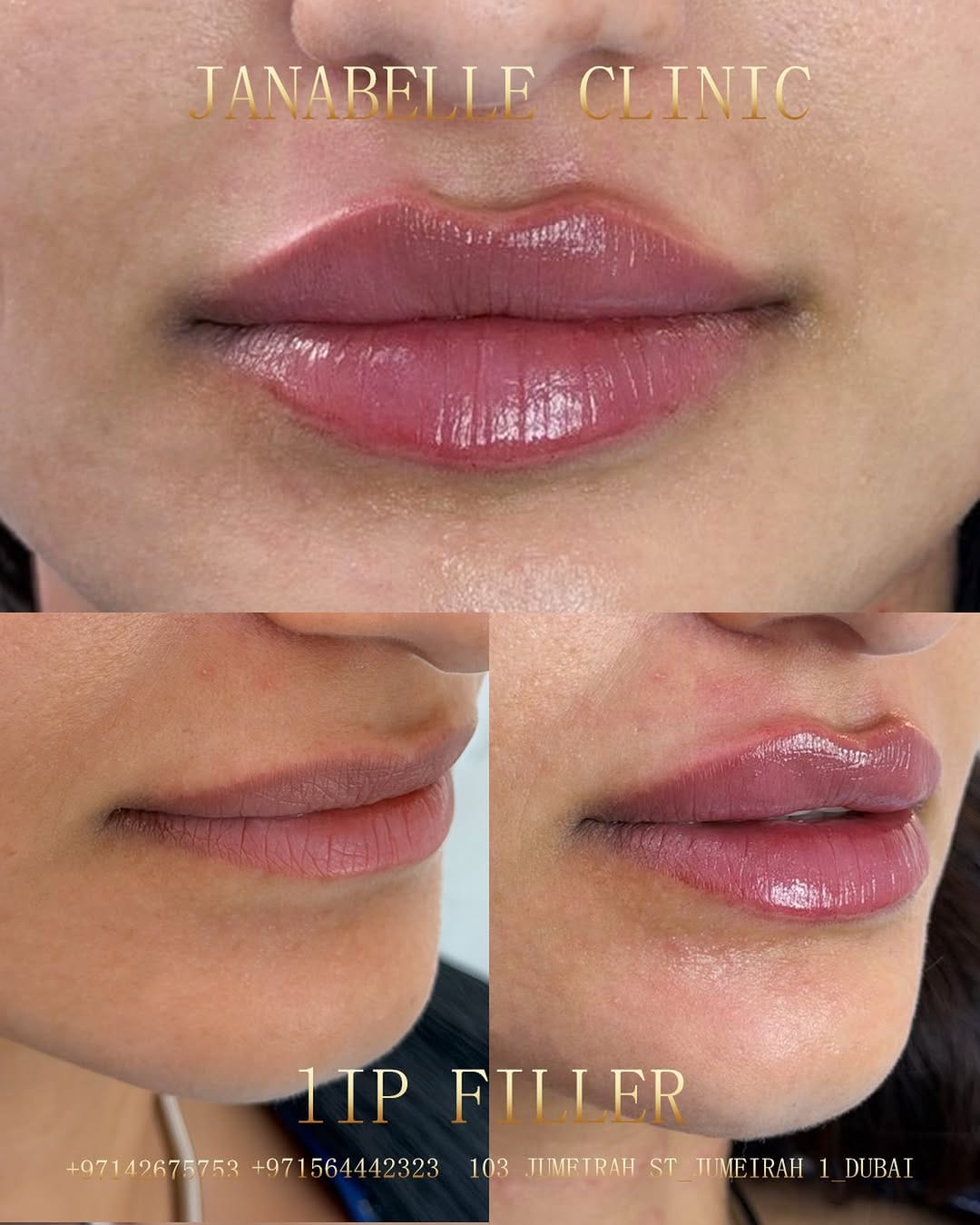 Post 5 by Janabelle Clinic on Instagram (image)