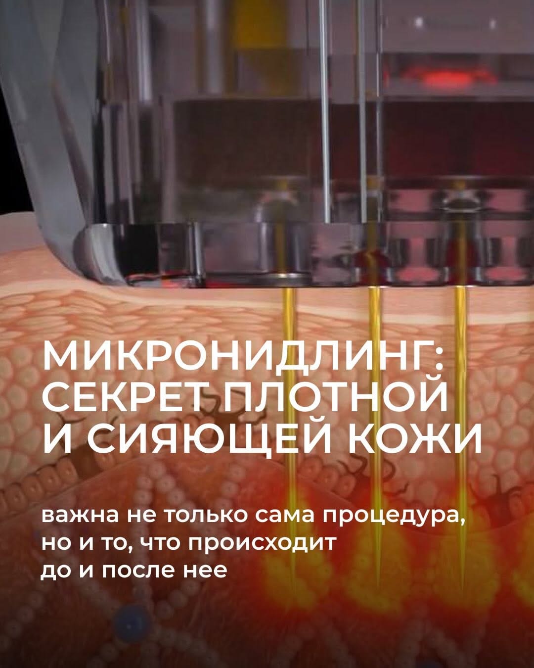 Post 3 by КЛИНИКА ЦИДК on Instagram (carousel)
