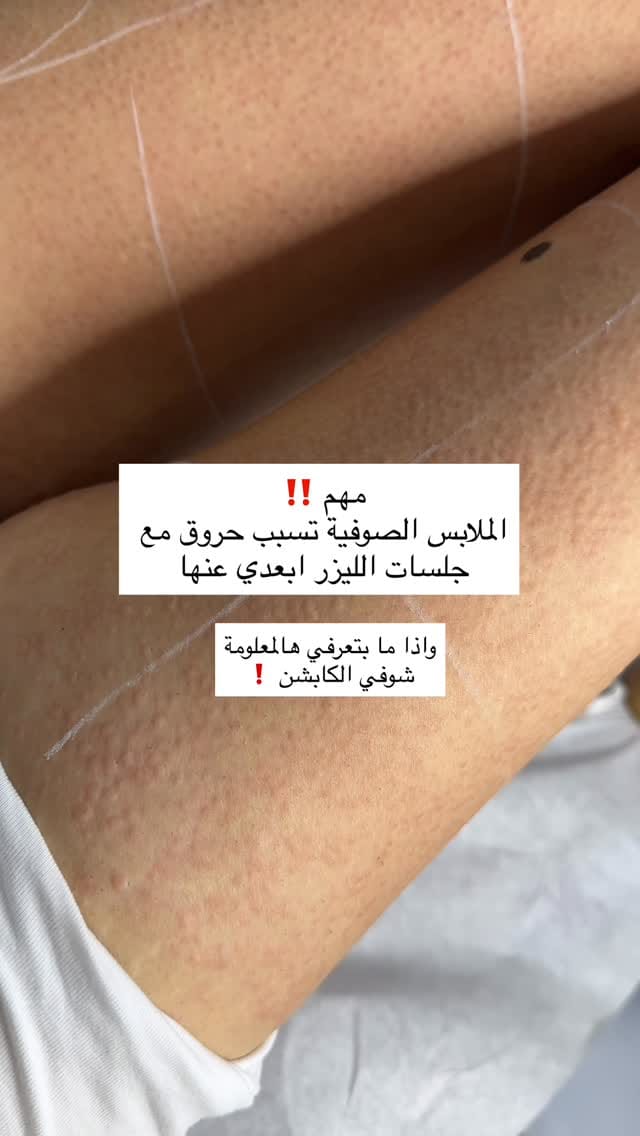 Post 4 by نشوى السوده | إخصائية ليزر وبشرة | Nashwa Alsoda on Instagram (video)
