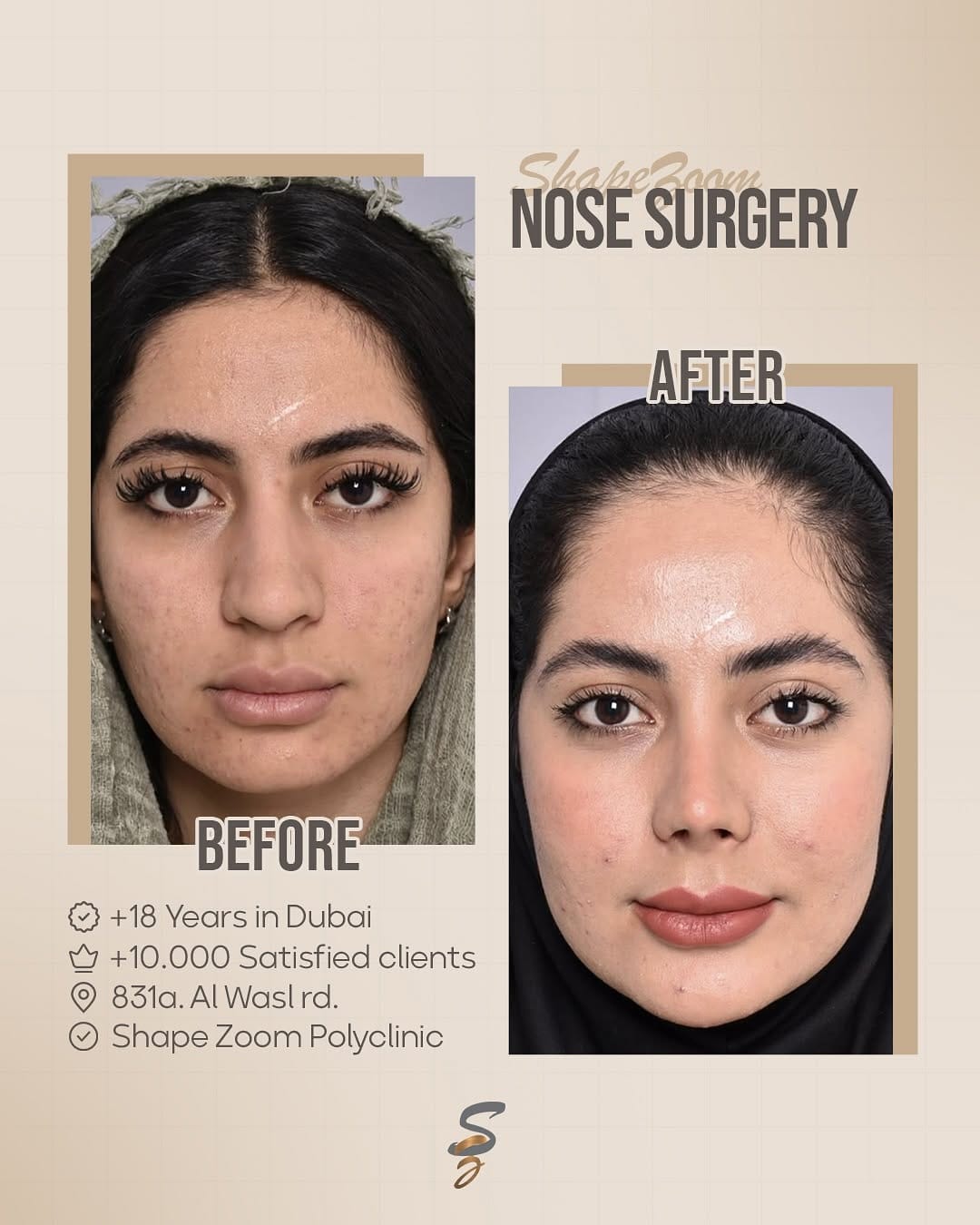 Post 4 by Shape Zoom Poly Clinic Dubai on Instagram (carousel)