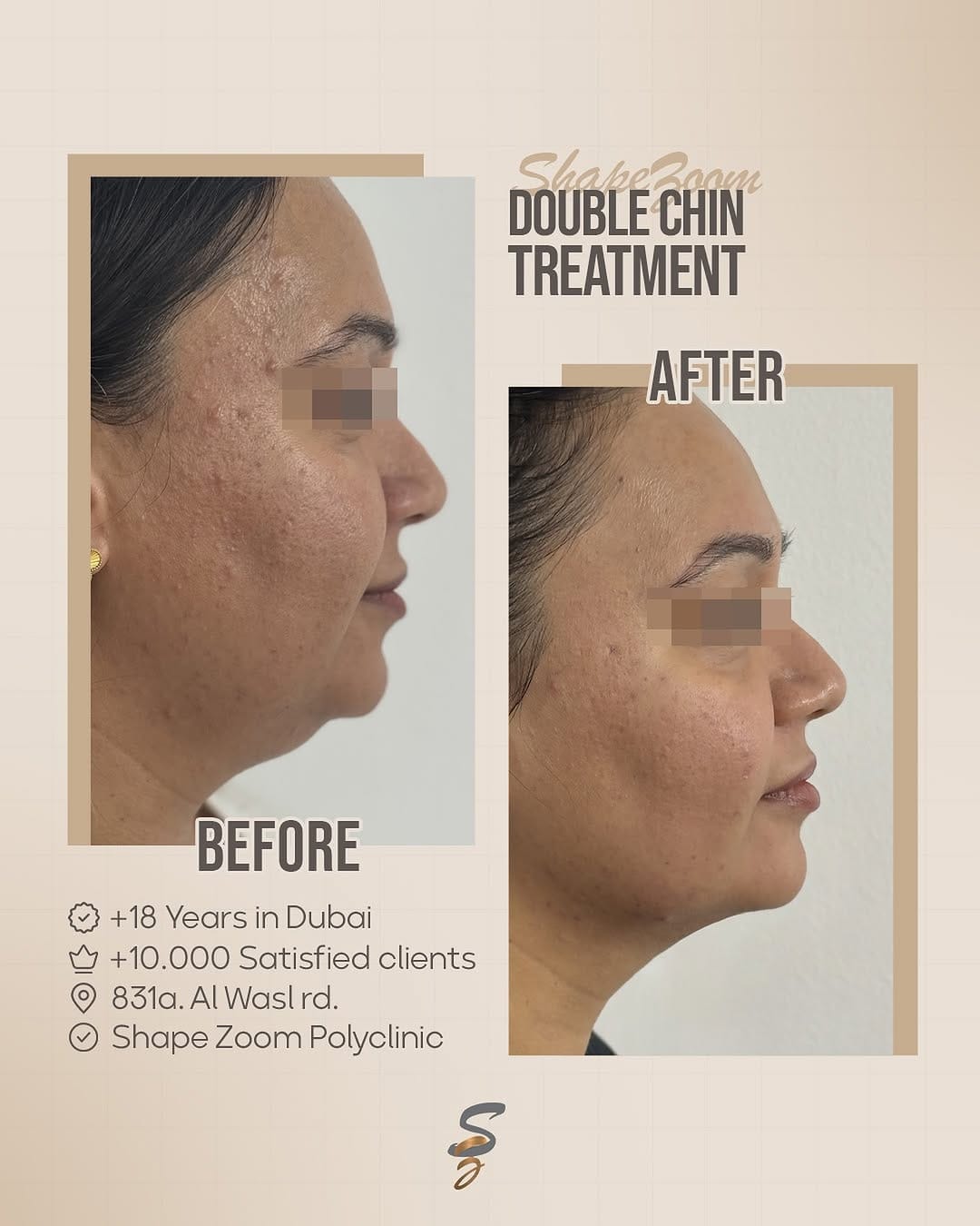 Post 7 by Shape Zoom Poly Clinic Dubai on Instagram (image)