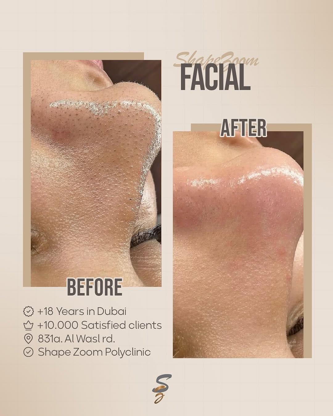 Post 10 by Shape Zoom Poly Clinic Dubai on Instagram (image)