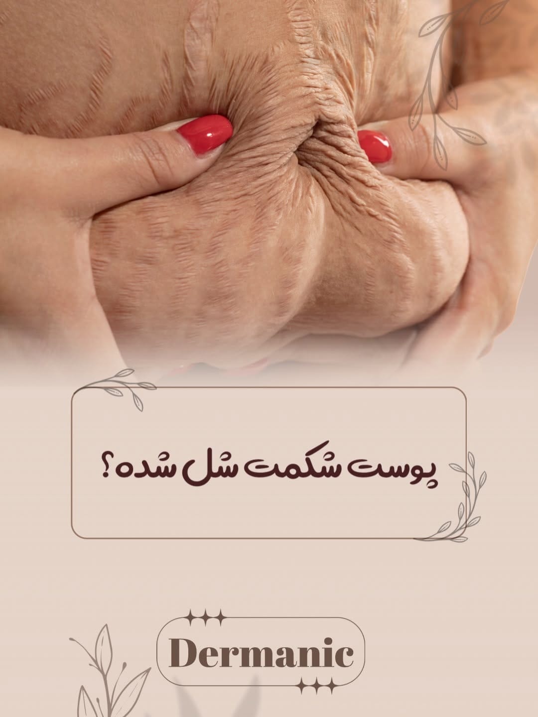 Post 3 by دکتر شیلا میرزاده |متخصص پوست،مو و زیبایی on Instagram (carousel)