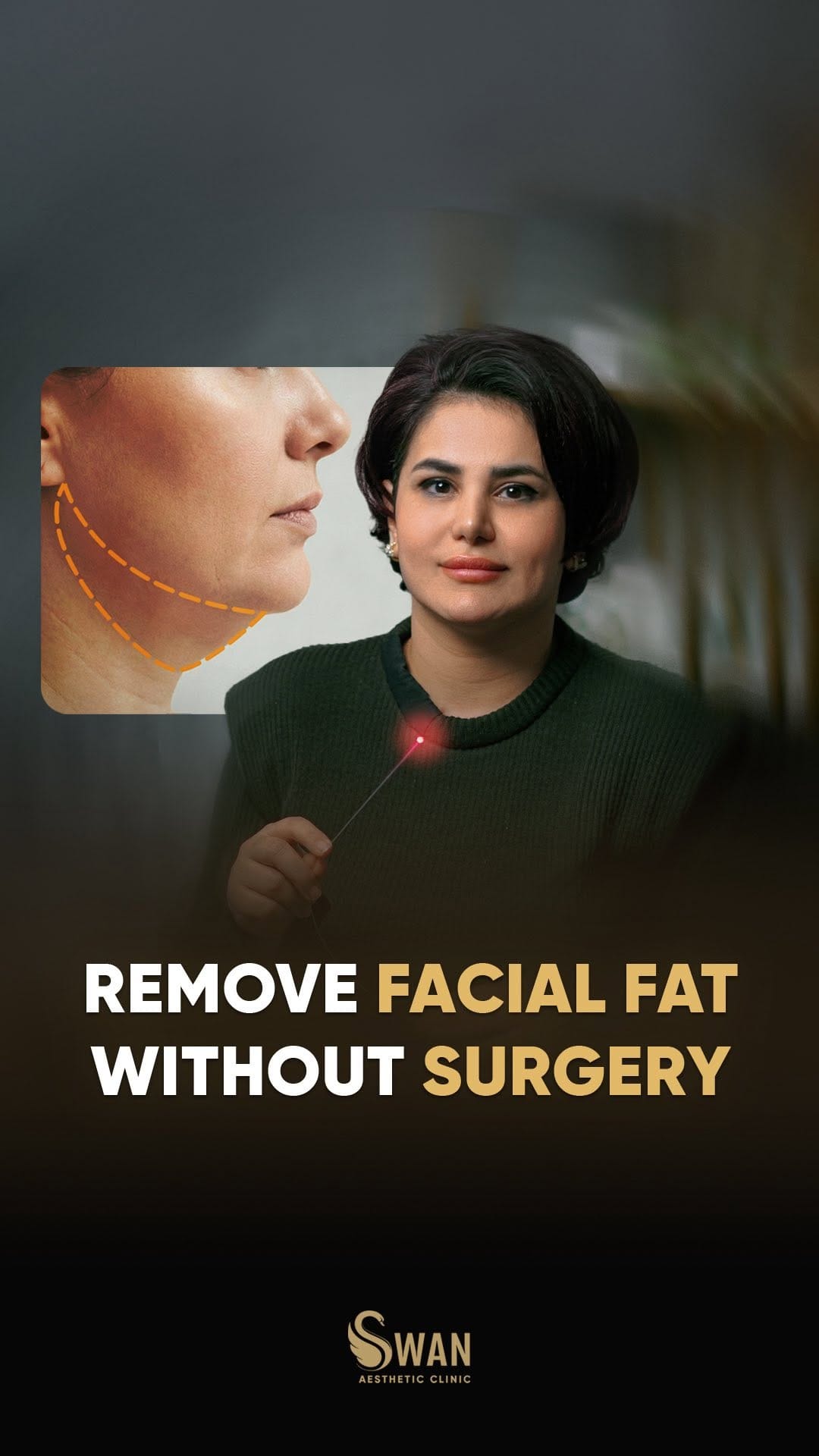 Post 4 by Swan Aesthetic Clinic on Instagram (video)
