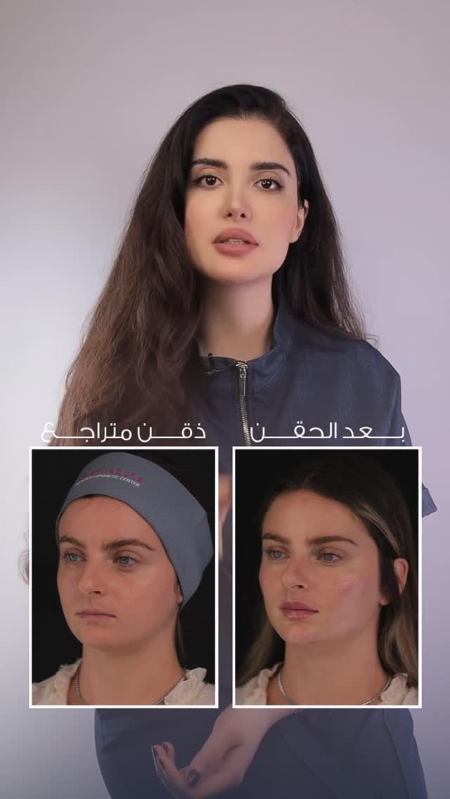 Post 10 by DermaZone on Instagram (video)