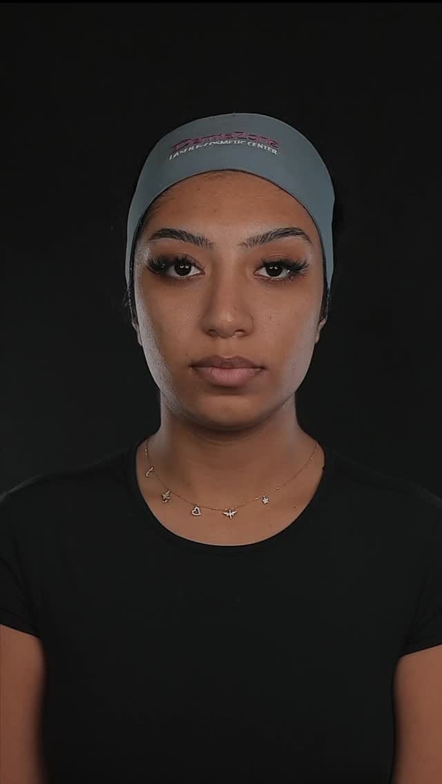 Post 8 by DermaZone on Instagram (video)