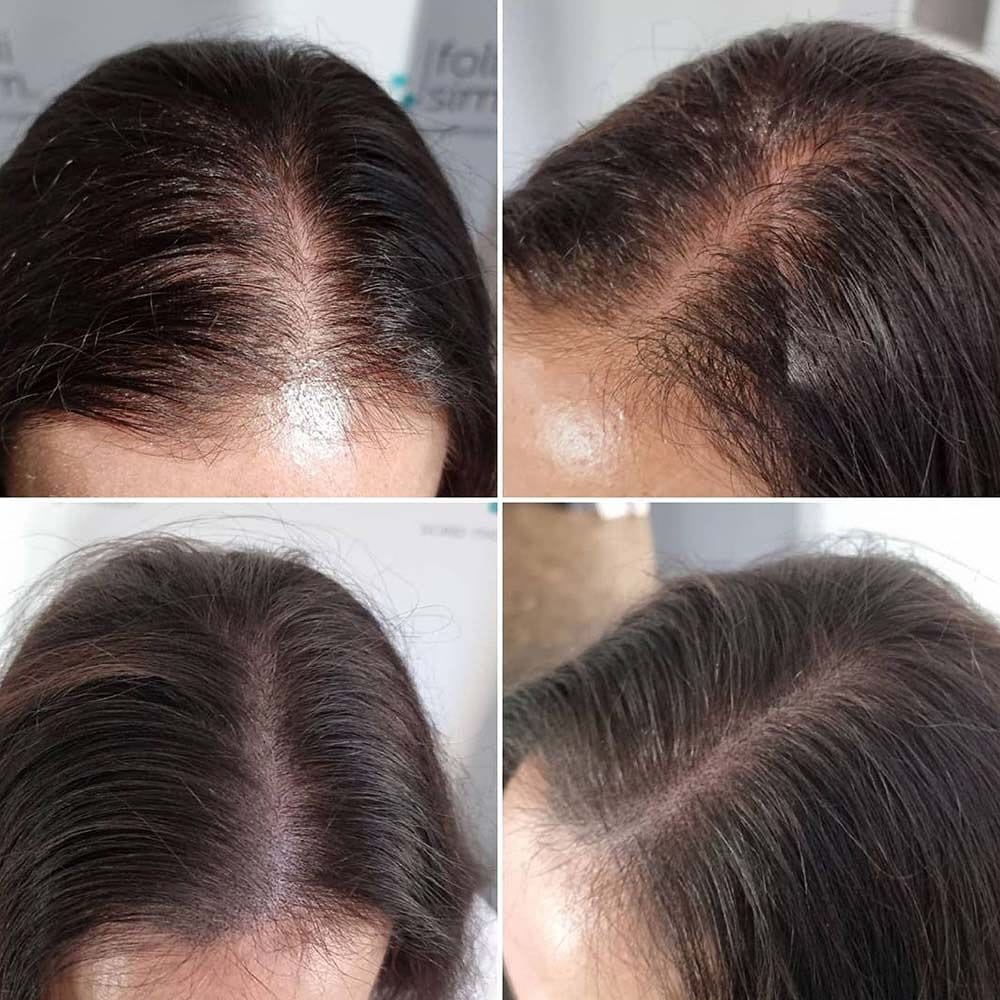 Post 8 by Permanent makeup UAE on Instagram (image)