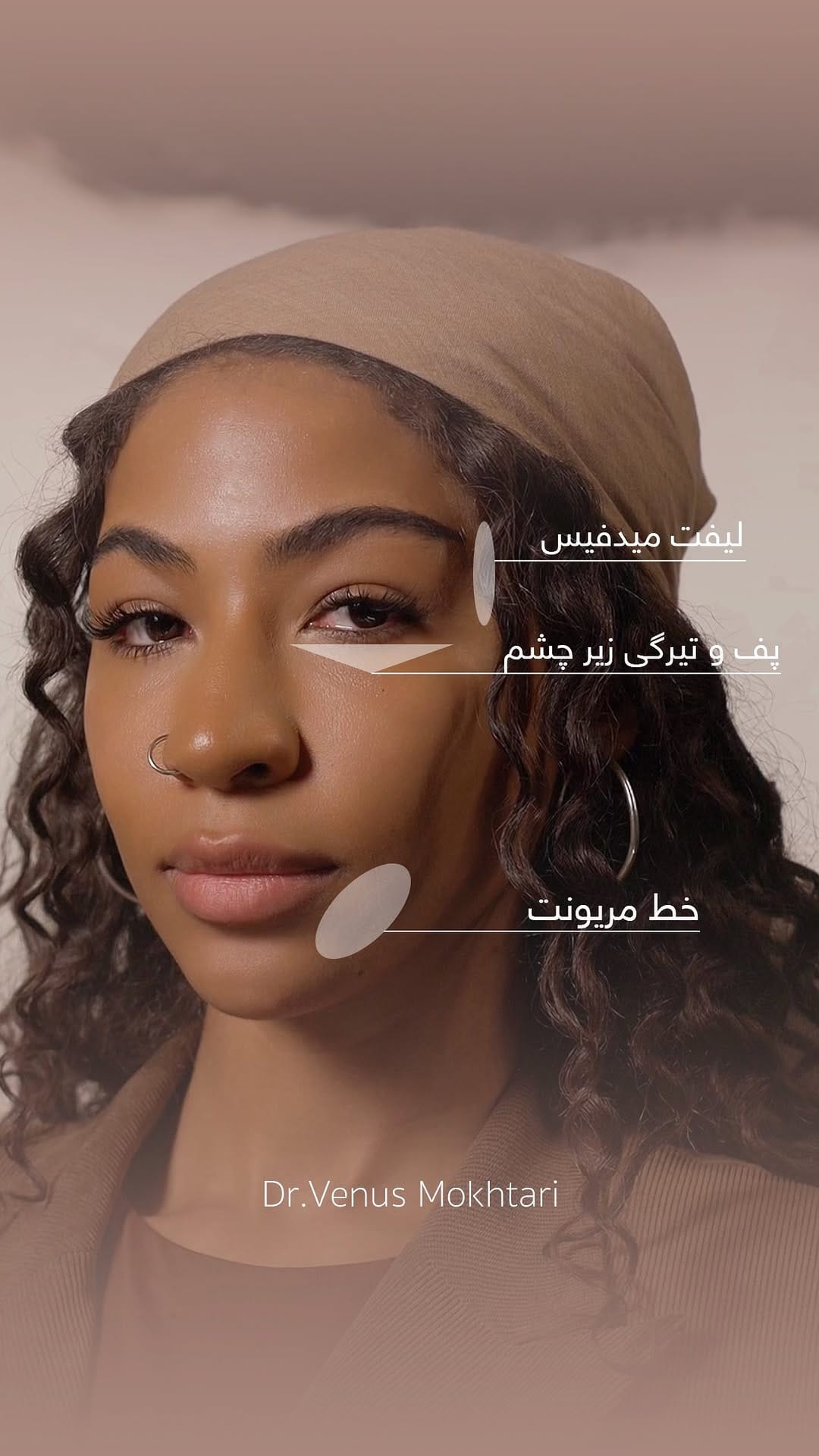 Post 10 by دکتر ونوس مختاری on Instagram (video)