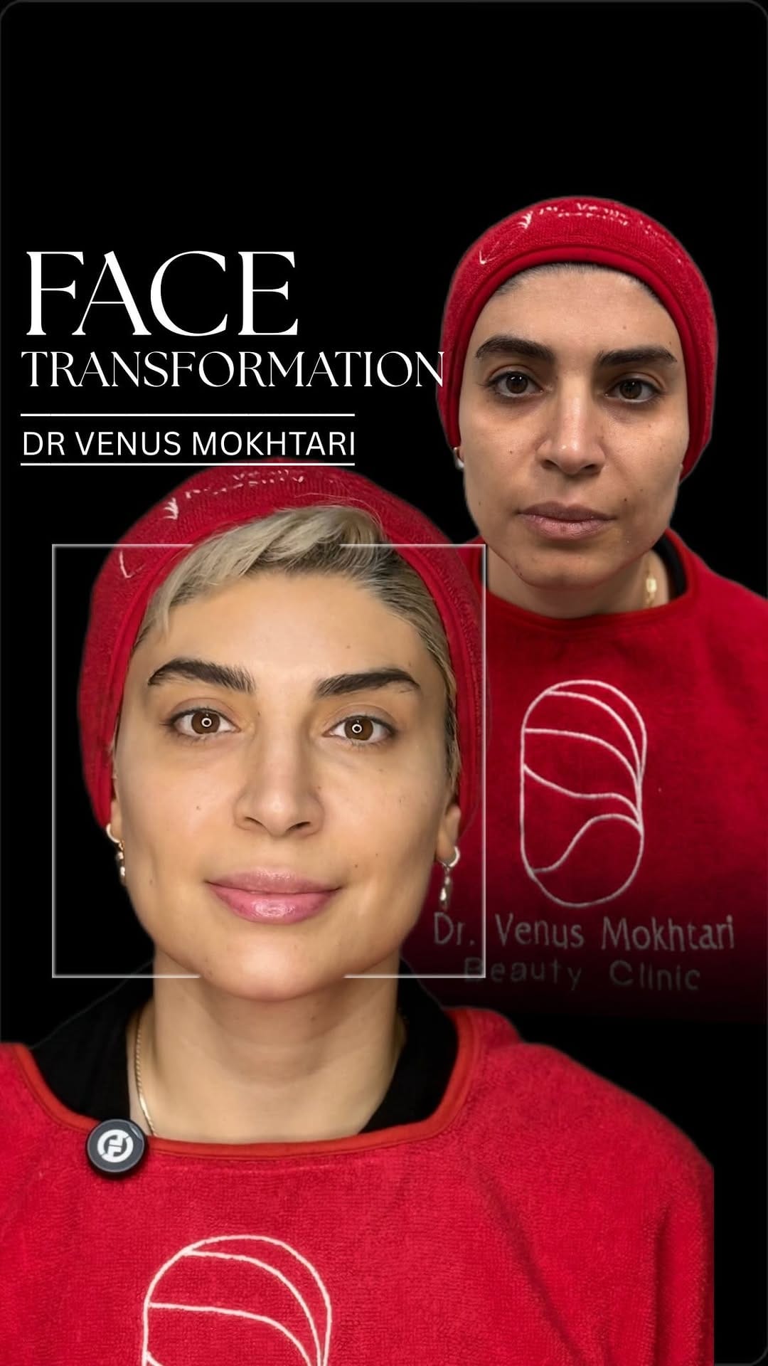 Post 6 by دکتر ونوس مختاری on Instagram (video)