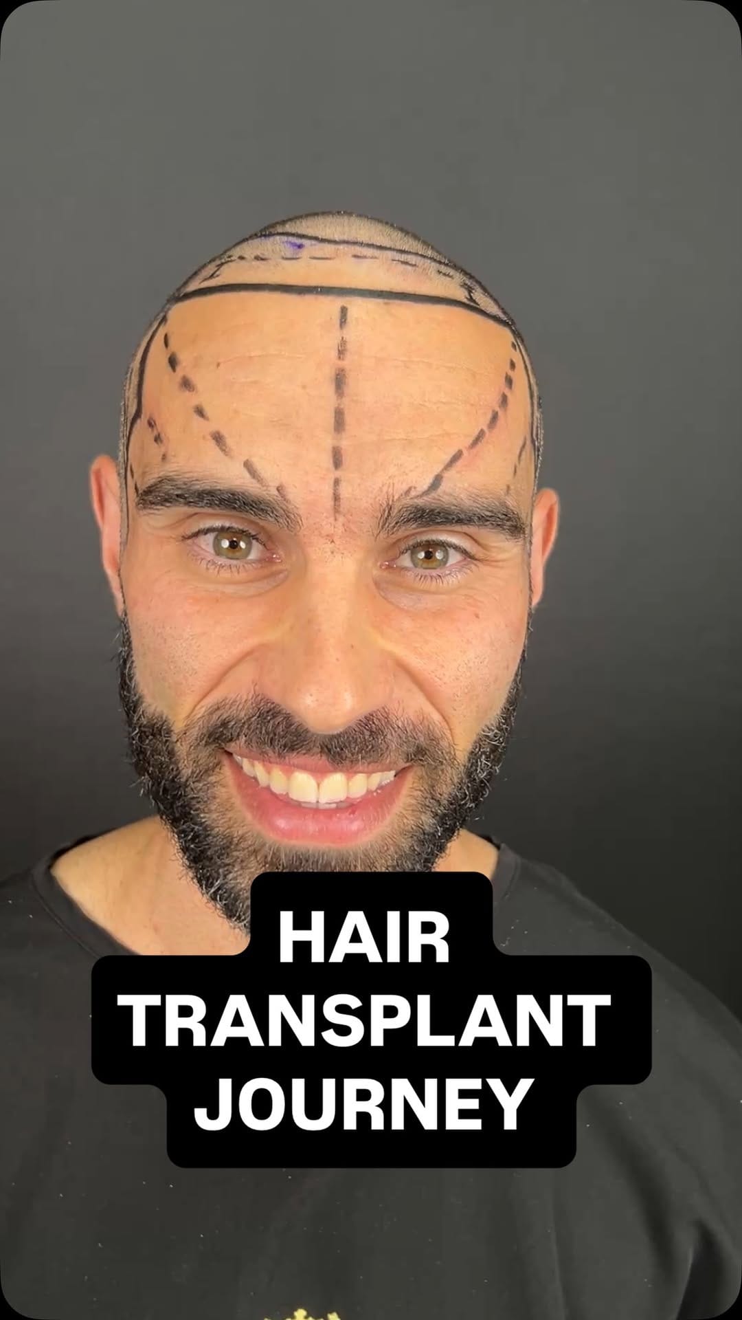 Post 6 by LUCAS AOUN | Formulator on Instagram (video)