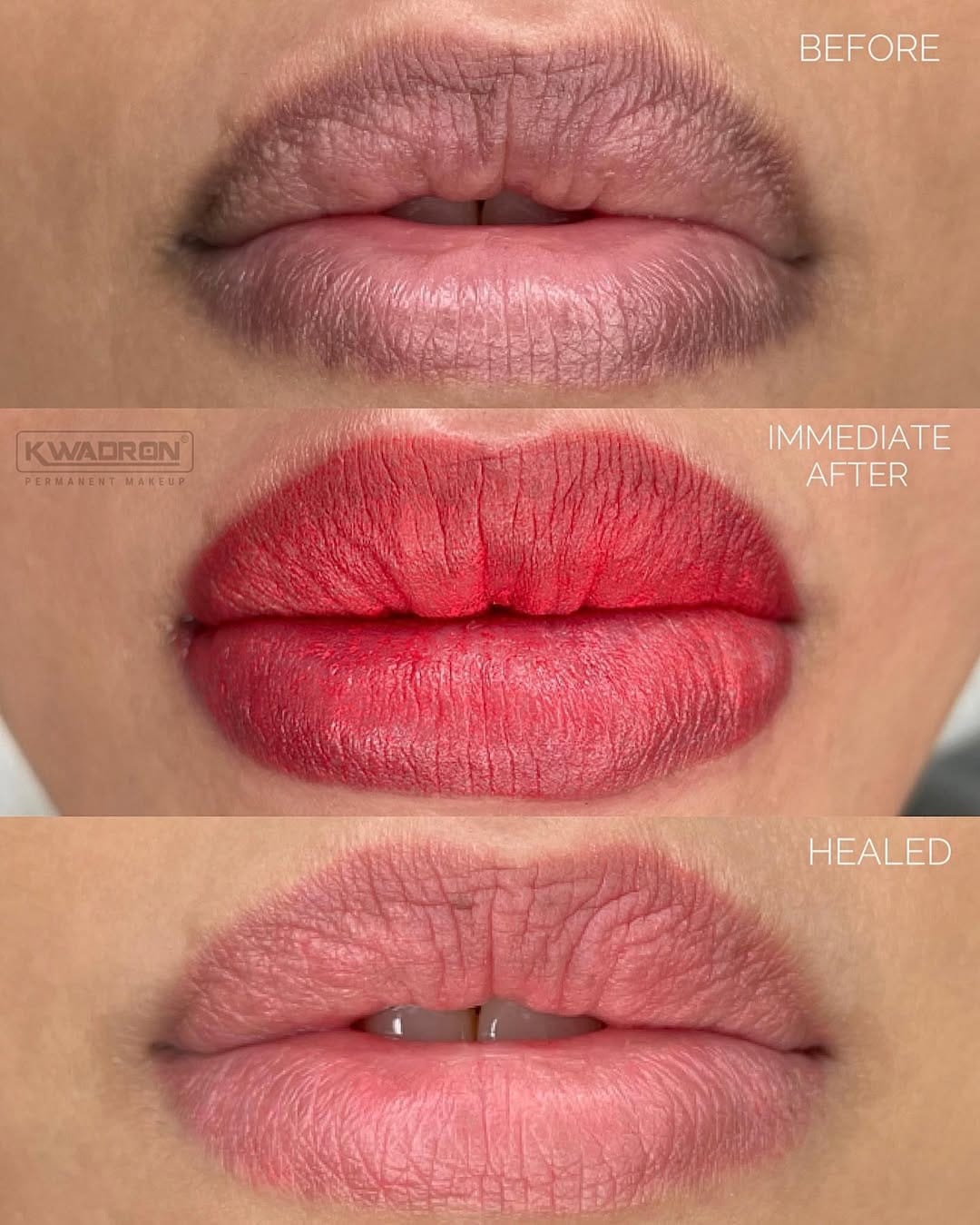 Post 10 by Kate Microblading Dubai on Instagram (image)