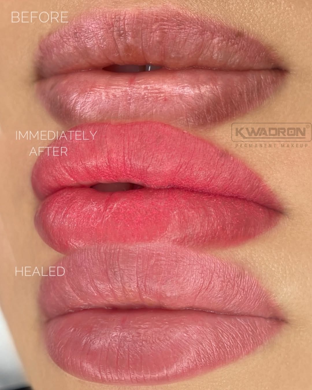 Post 5 by Kate Microblading Dubai on Instagram (image)