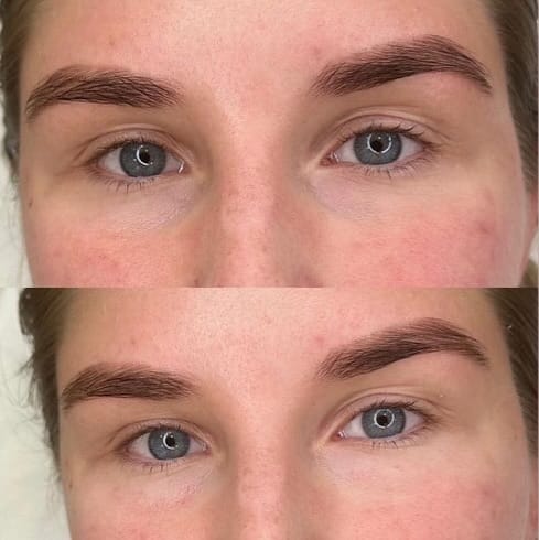 Post 9 by DermaScience.uae on Instagram (image)
