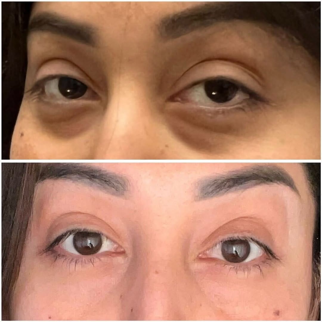 Post 8 by DermaScience.uae on Instagram (image)