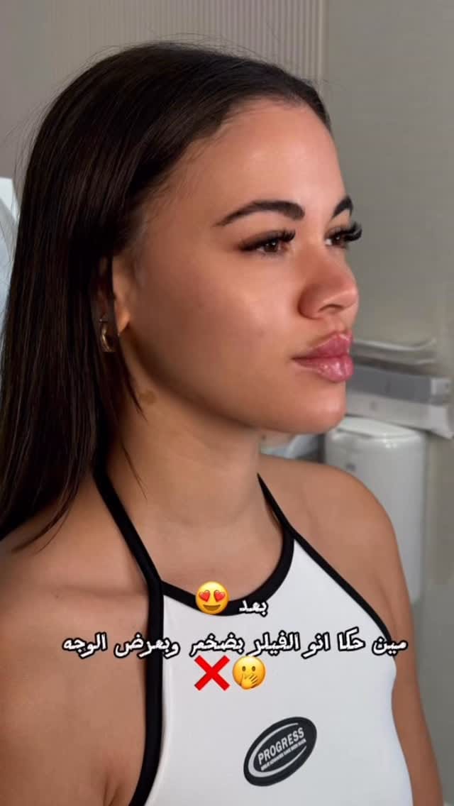 Post 6 by الدكتورة سوزان الدرع on Instagram (video)