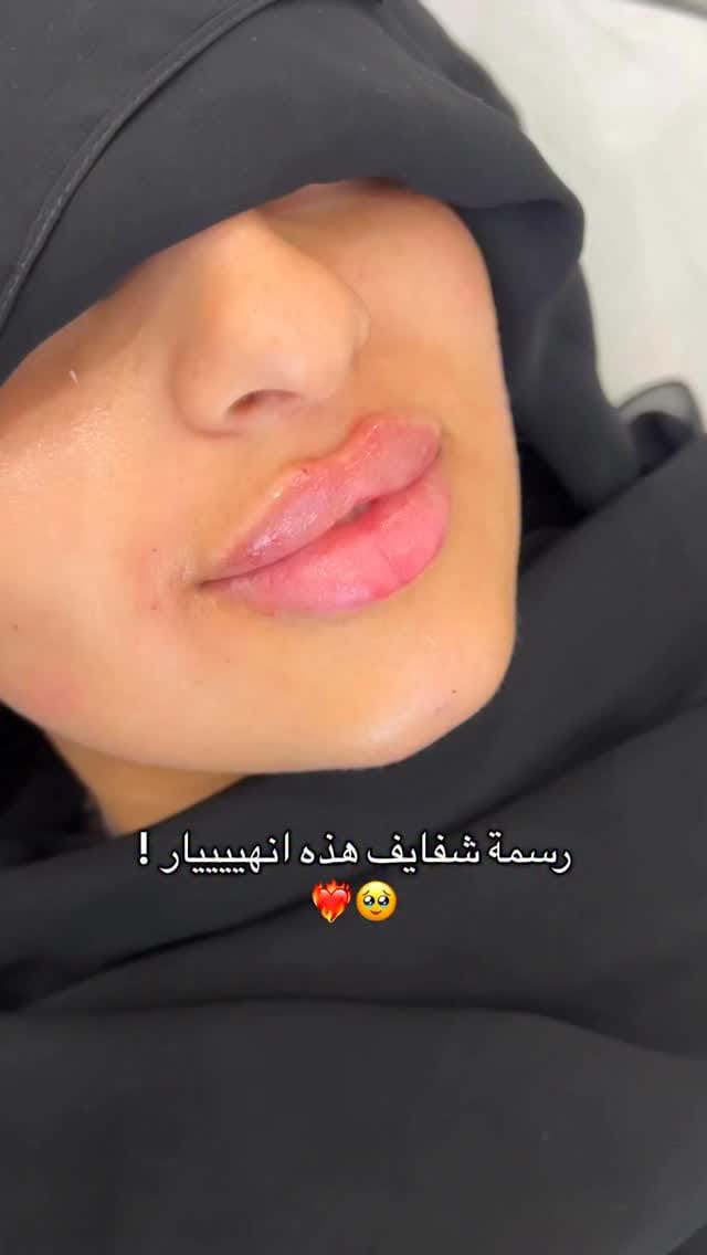 Post 7 by الدكتورة سوزان الدرع on Instagram (video)