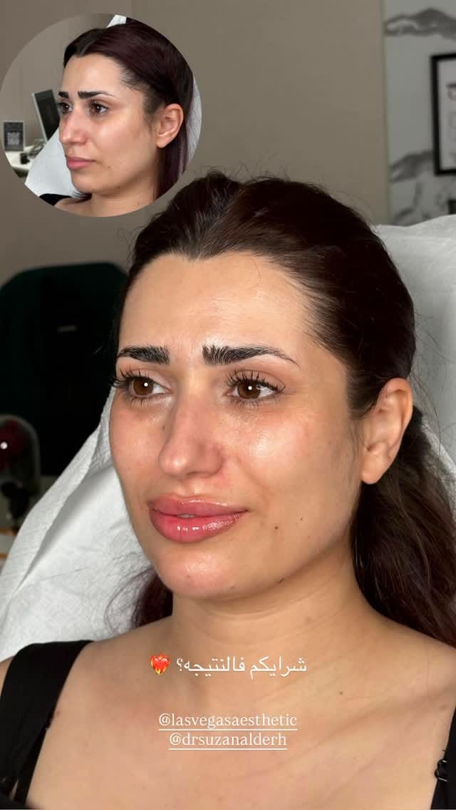 Post 3 by الدكتورة سوزان الدرع on Instagram (video)