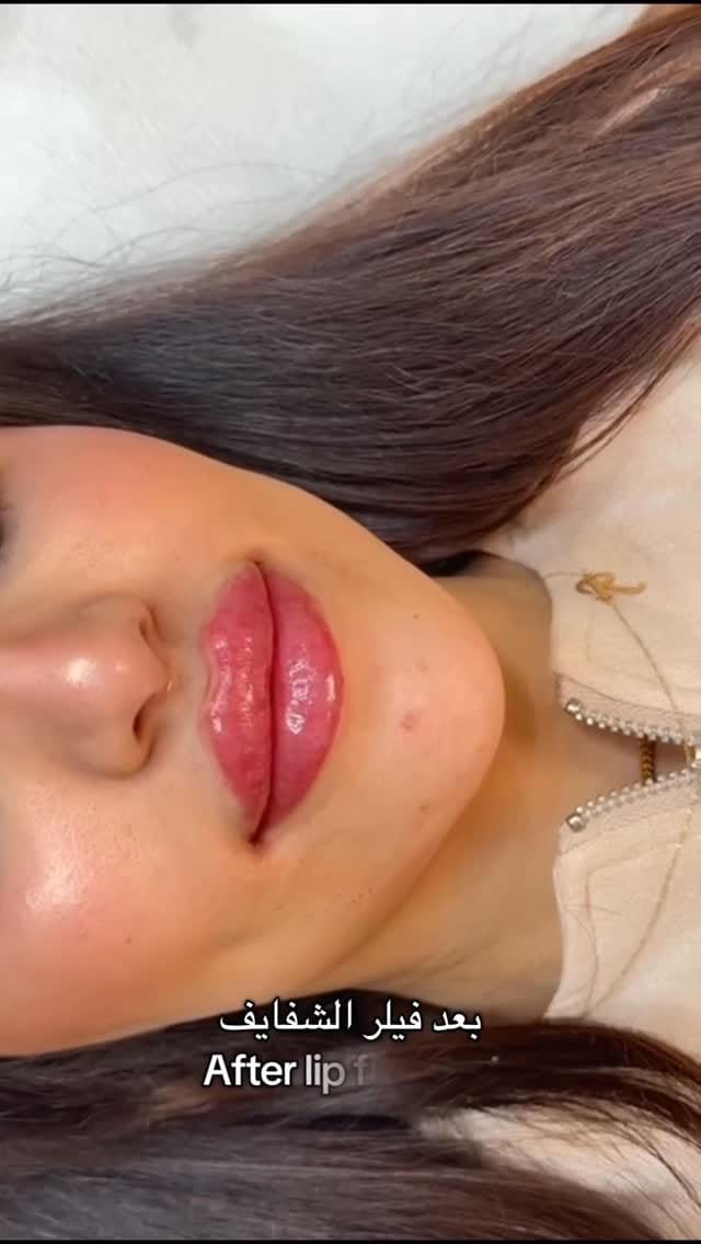 Post 5 by الدكتورة سوزان الدرع on Instagram (video)