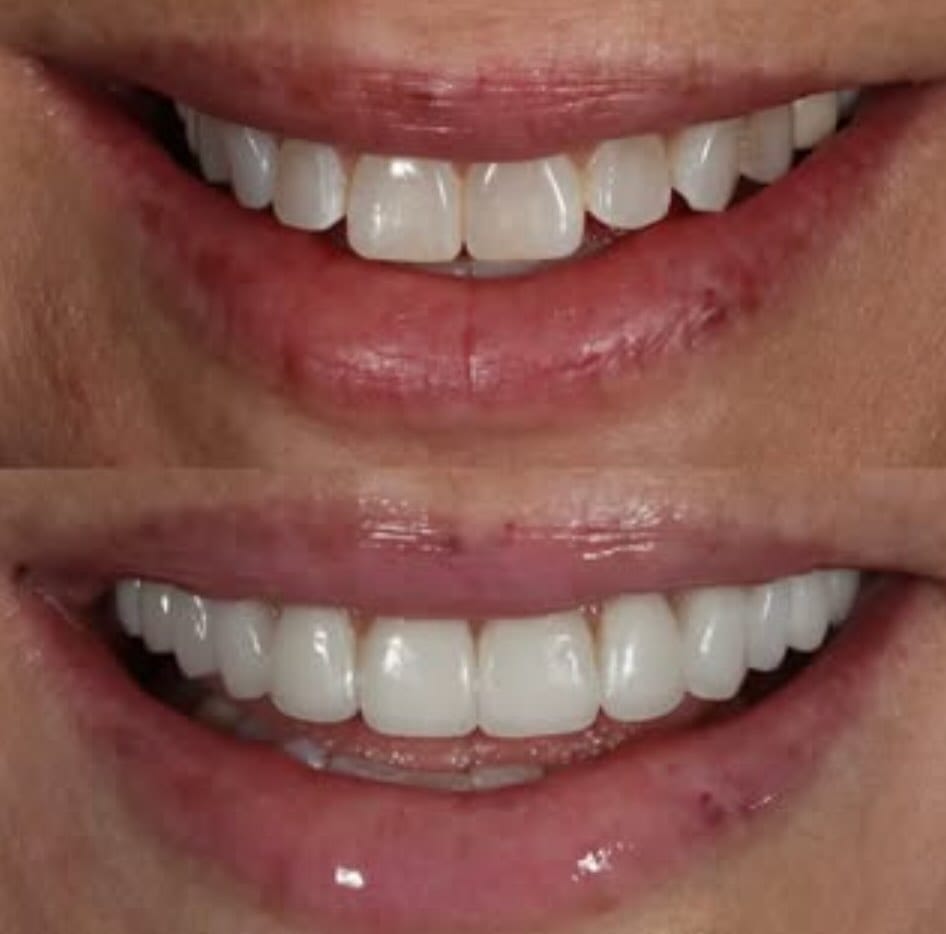 Post 3 by Dr. Victoria Rose Veytsman DDS on Instagram (image)