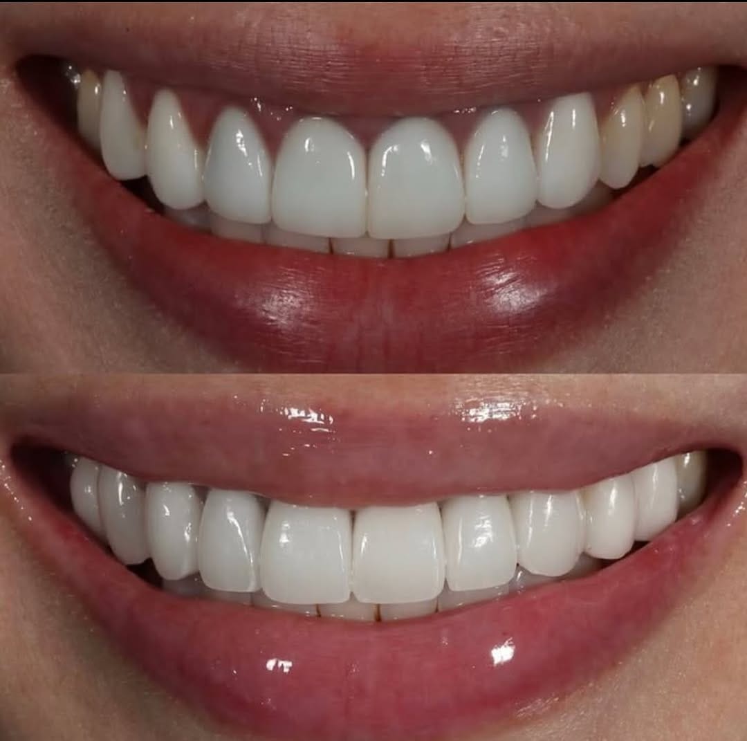 Post 7 by Dr. Victoria Rose Veytsman DDS on Instagram (image)