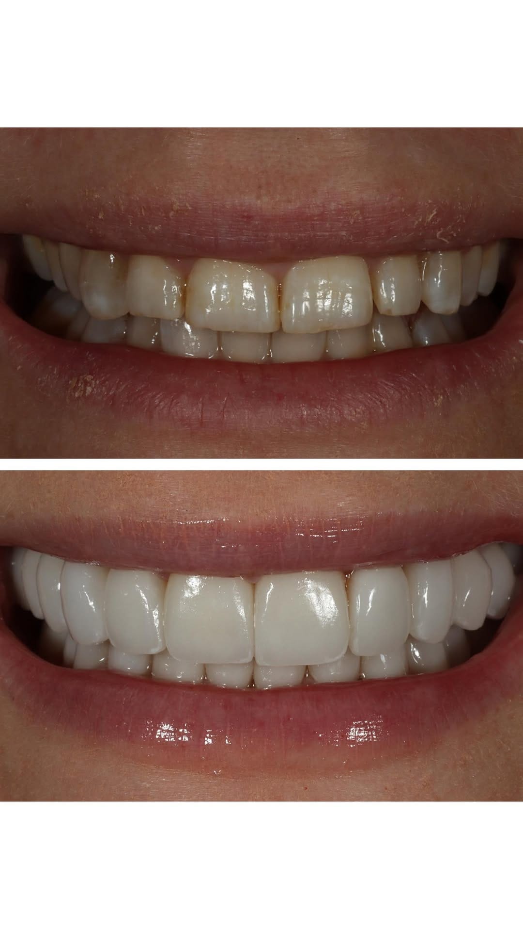 Post 1 by Dr. Victoria Rose Veytsman DDS on Instagram (video)