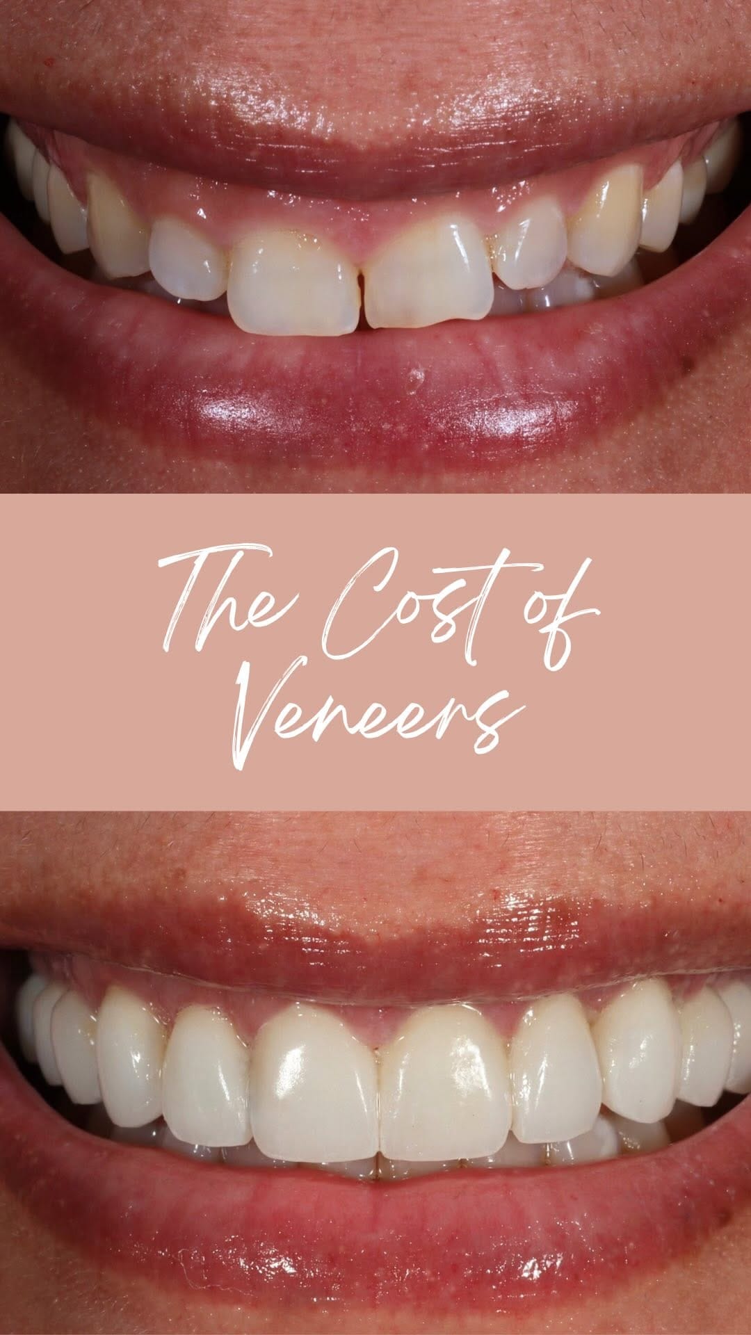 Post 8 by Dr. Victoria Rose Veytsman DDS on Instagram (video)