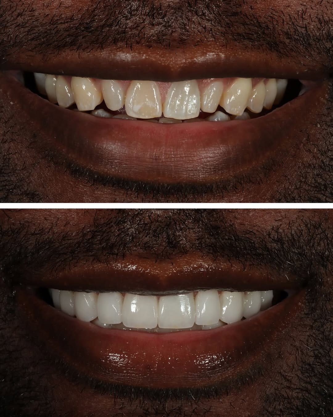 Post 5 by Dr. Victoria Rose Veytsman DDS on Instagram (image)