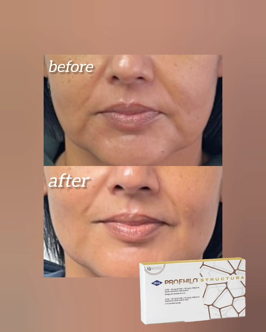 Post 6 by Dr. Mirela V. Telipan on Instagram (image)