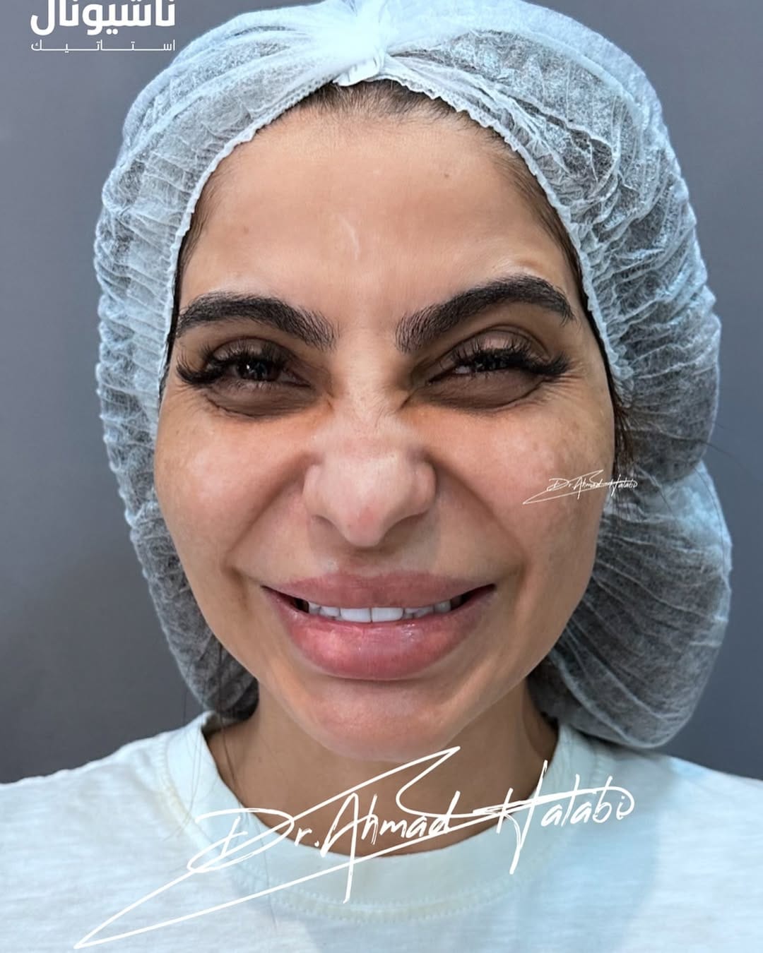 Post 1 by ناشيونال أستاتيك|National Estetik on Instagram (carousel)