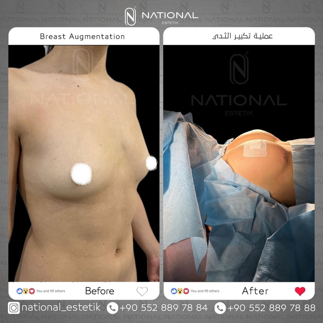 Post 6 by ناشيونال أستاتيك|National Estetik on Instagram (image)