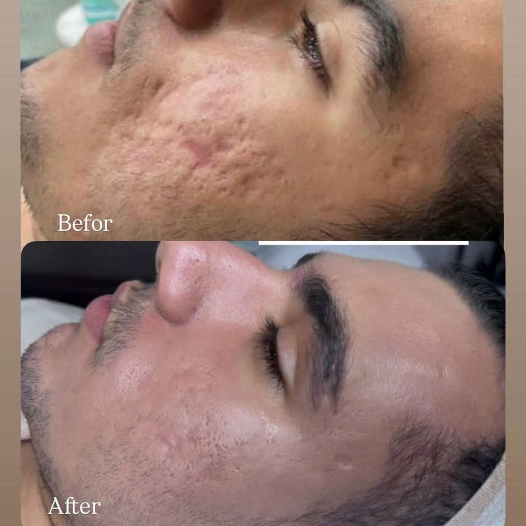 Post 7 by آکادمی تخصصی پوست رویا دهقانی on Instagram (image)