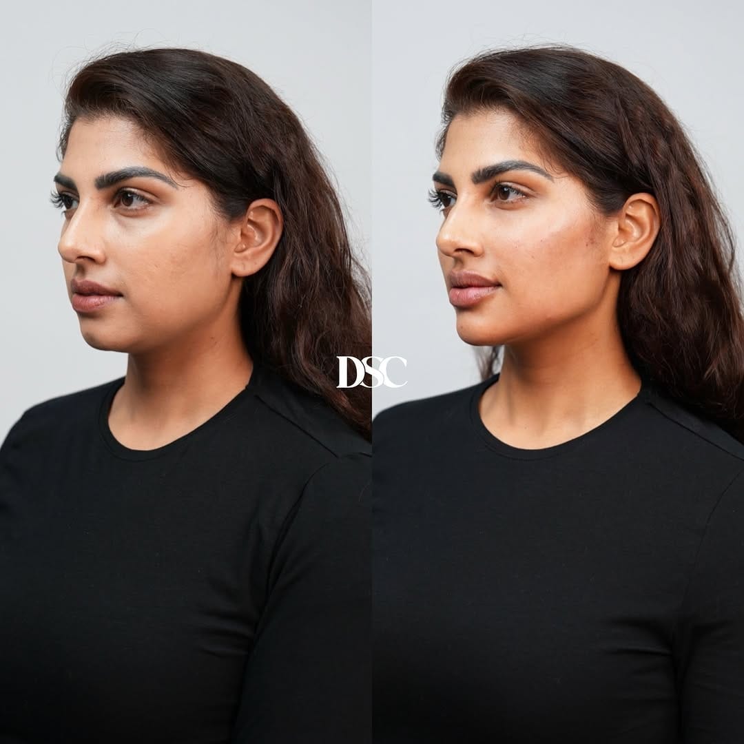 Post 1 by Drs. Samana Clinics | DSC on Instagram (carousel)
