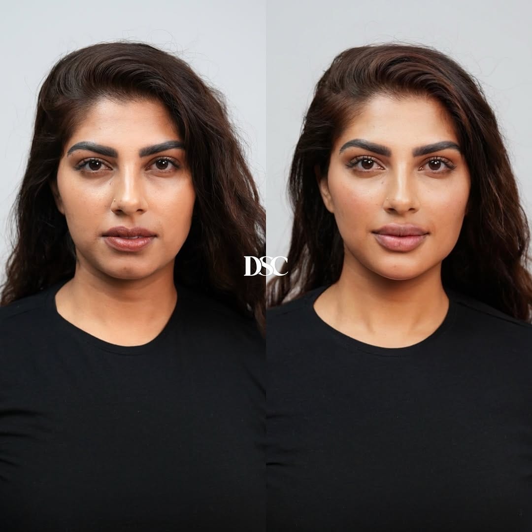 Post 4 by Drs. Samana Clinics | DSC on Instagram (image)