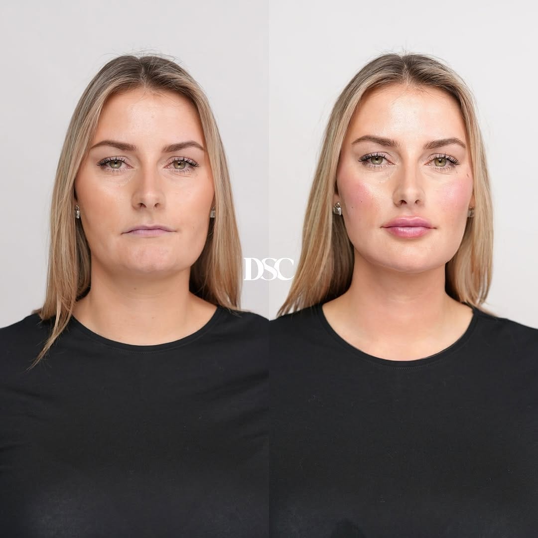 Post 8 by Drs. Samana Clinics | DSC on Instagram (image)