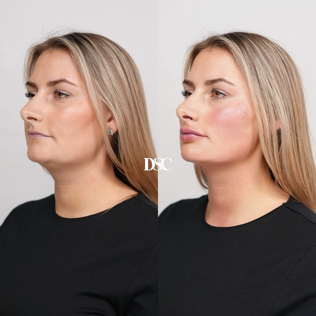 Post 7 by Drs. Samana Clinics | DSC on Instagram (image)