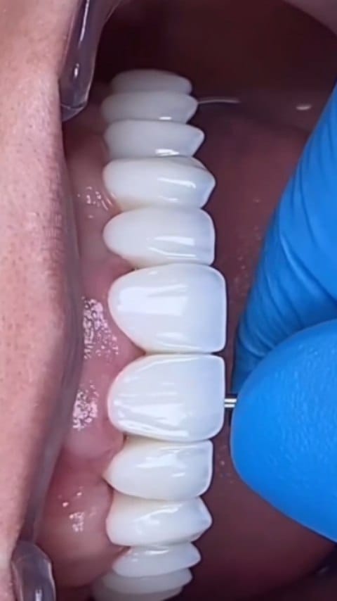 Post 3 by dr Randa Zein on Instagram (video)