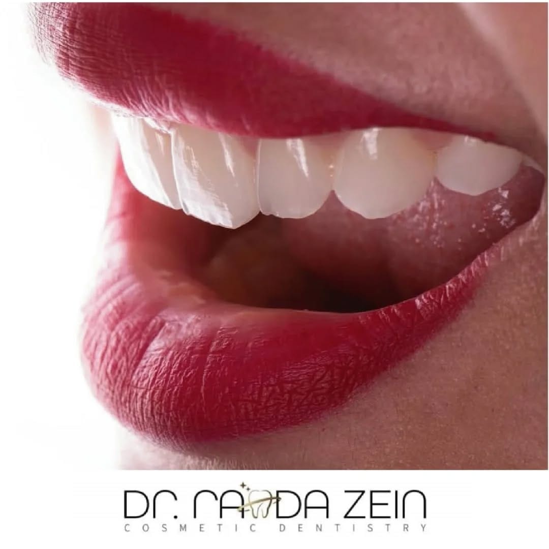 Post 7 by dr Randa Zein on Instagram (image)