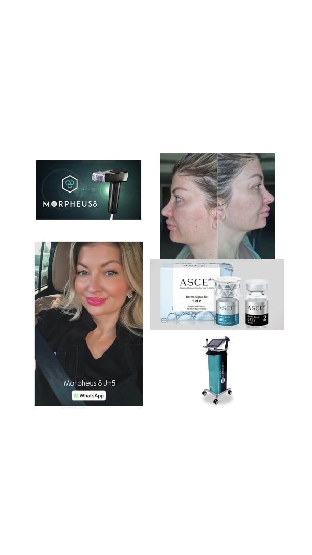 Post 3 by Gaëlle | Aesthetic | Medical | Beauty on Instagram (video)