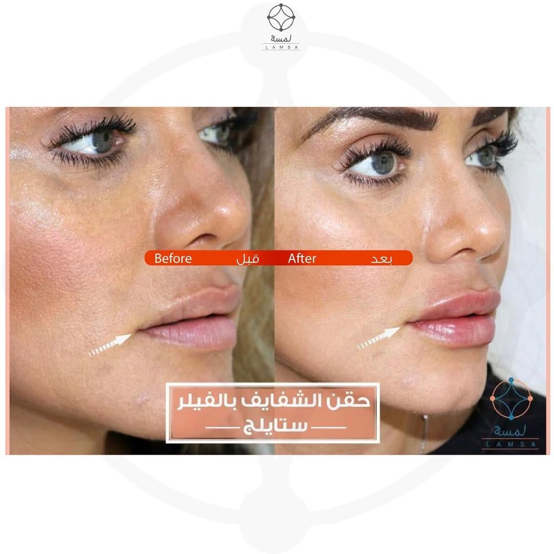 Post 9 by Lamsa Dubai on Instagram (image)