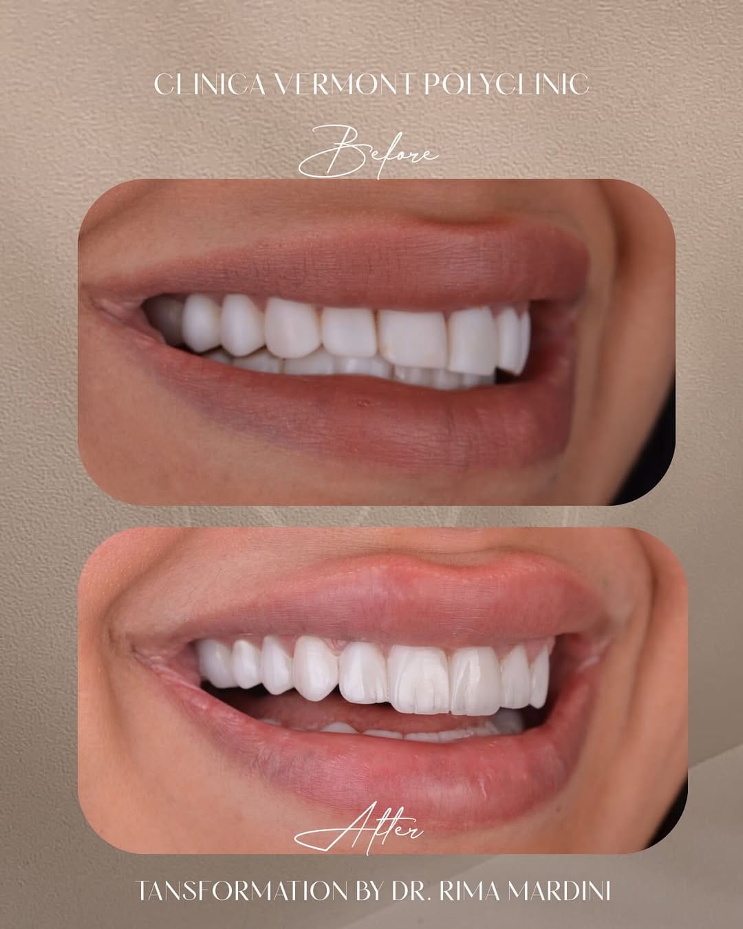 Post 4 by كلينيكا فيرمونت Clinica Vermont on Instagram (image)