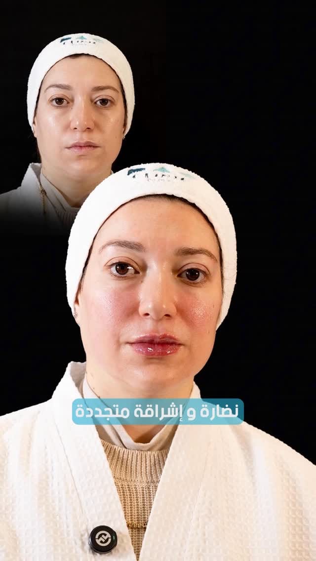 Post 5 by Dr. Momena Nagy | Aesthetics | UAE on Instagram (video)