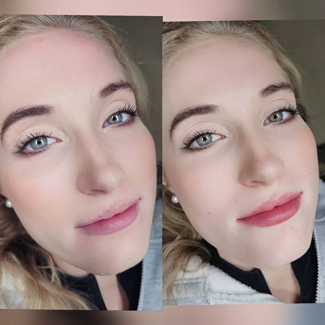 Post 1 by Korean beauty in dubai✨️ on Instagram (image)